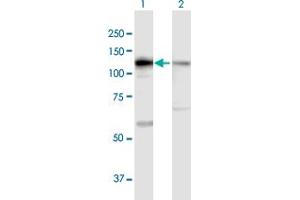 Western Blot analysis of DIS3 expression in transfected 293T cell line by DIS3 MaxPab polyclonal antibody. (DIS3 抗体  (AA 1-958))
