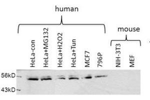 USP30 antibody - middle region  validated by WB using Hela cell lysate