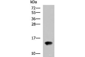 Western blot analysis of Rat kidney tissue lysate using FAM19A4 Polyclonal Antibody at dilution of 1:650 (FAM19A4 抗体)