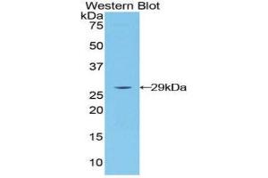 Western Blotting (WB) image for anti-Lymphocyte-Activation Gene 3 (LAG3) (AA 274-504) antibody (ABIN1859591) (LAG3 抗体  (AA 274-504))