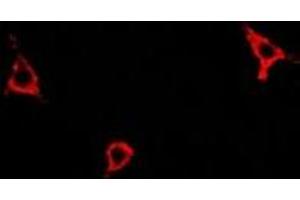 Immunofluorescent analysis of Asparagine Synthetase staining in A549 cells. (Asparagine Synthetase 抗体)