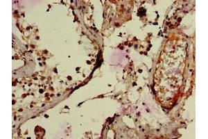 Immunohistochemistry of paraffin-embedded human testis tissue using ABIN7151134 at dilution of 1:100 (RNF126 抗体  (AA 39-225))