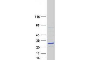 Western Blotting (WB) image for Synovial Sarcoma, X Breakpoint 3 (SSX3) (Transcript Variant 1) protein (Myc-DYKDDDDK Tag) (ABIN2732734)