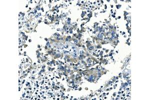 IHC analysis of Kir6.