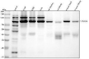 Western blot analysis of PRKCA using anti-PRKCA antibody (ABIN7603410).