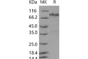 Western Blotting (WB) image for Notch 1 (NOTCH1) (Active) protein (His tag) (ABIN7197217) (Notch1 Protein (His tag))