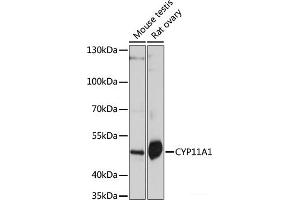Western blot analysis of extracts of various cell lines using CYP11A1 Polyclonal Antibody at dilution of 1:1000. (CYP11A1 抗体)