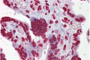 Immunohistochemistry with Placenta tissue at an antibody concentration of 5µg/ml using anti-EGR3 antibody (ARP34197_P050) (EGR3 抗体  (Middle Region))