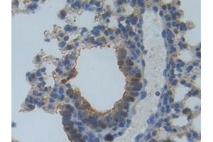 Detection of MYO1A in Mouse Lung Tissue using Polyclonal Antibody to Myosin IA (MYO1A) (Myosin IA 抗体  (AA 783-1043))