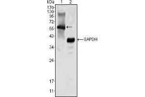 Western blot analysis using MATK mouse mAb against K562 cell lysate (1). (MATK 抗体)