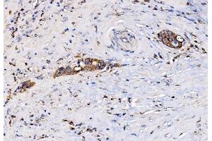 IHC analysis of MIRO1/RHOT1 using anti-MIRO1/RHOT1 antibody (ABIN7602209).