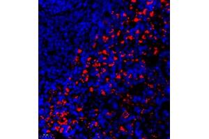 Immunofluorescence (Paraffin-embedded Sections) (IF (p)) image for anti-Prothymosin, alpha (PTMA) antibody (ABIN7075306)