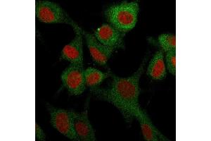 Immunofluorescence (IF) image for anti-5'-Nucleotidase, Ecto (CD73) (NT5E) antibody (ABIN6940227)