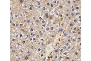 Immunohistochemistry of paraffin-embedded Rat liver using HSF2 Polyclonal Antibody at dilution of 1:200 (40x lens). (HSF2 抗体)