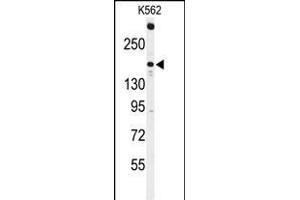 Western blot analysis of ACK1 Antibody (N-term) (ABIN392082 and ABIN2841841) in K562 cell line lysates (35 μg/lane). (TNK2 抗体  (N-Term))