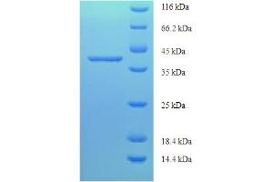 LARP1B Protein (AA 1-201, full length) (His-SUMO Tag)