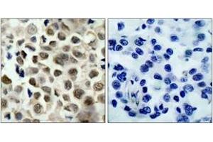 Immunohistochemistry (IHC) image for anti-Histone Deacetylase 8 (HDAC8) (AA 5-54), (pSer39) antibody (ABIN1531858)
