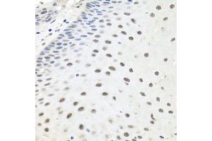 Immunohistochemistry of paraffin-embedded human esophagus using EXO1 antibody (ABIN6129824, ABIN6140356, ABIN6140357 and ABIN6219087) at dilution of 1:100 (40x lens). (Exonuclease 1 抗体  (AA 601-846))