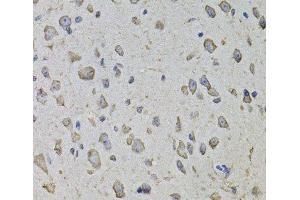 Immunohistochemistry of paraffin-embedded Mouse brain using ARHGEF3 Polyclonal Antibody at dilution of 1:100 (40x lens). (ARHGEF3 抗体)