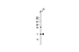 Anti-SFT2D2 Antibody at 1:1000 dilution + PC-12 whole cell lysates Lysates/proteins at 20 μg per lane. (SFT2D2 抗体)