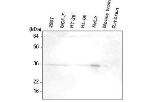 The extracts of 293T, MCF7, HT-29, HL-60, HeLa, mouse brain, and rat brain were resolved by SDS-PAGE, transferred to PVDF membrane and probed with anti-human HtrA2/Omi antibody (1:1,000).