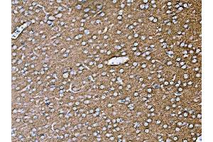 IHC analysis of SYP using anti-SYP antibody (ABIN7603120). (Synaptophysin 抗体  (N-Term))