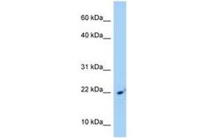 Image no. 1 for anti-Signal Recognition Particle 14kDa (Homologous Alu RNA Binding Protein) (SRP14) (AA 81-130) antibody (ABIN6748137)