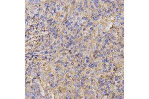 Immunohistochemistry (IHC) image for anti-Glycoprotein IX (Platelet) (GP9) antibody (ABIN1876562) (CD42a 抗体)