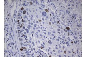 Image no. 1 for anti-Antigen Identified By Monoclonal Antibody Ki-67 (MKI67) (AA 1160-1493) antibody (ABIN1490856) (Ki-67 抗体  (AA 1160-1493))