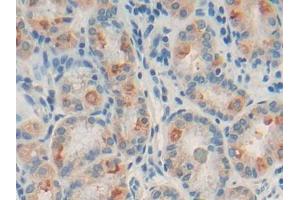 DAB staining on IHC-P; Samples: Human Stomach Tissue (CD22 抗体  (AA 28-246))