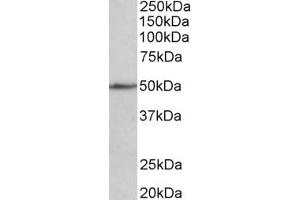 Western Blotting (WB) image for anti-Cell Adhesion Molecule 1 (CADM1) (AA 125-137) antibody (ABIN1100375) (CADM1 抗体  (AA 125-137))