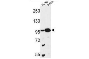 Western blot analysis of CSPP1 Antibody (N-term) in HL-60, Jurkat cell line lysates (35µg/lane). (CSPP1 抗体  (N-Term))