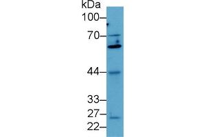 Detection of Smad4 in Human MCF7 cell lysate using Polyclonal Antibody to Mothers Against Decapentaplegic Homolog 4 (Smad4) (SMAD4 抗体  (AA 9-231))