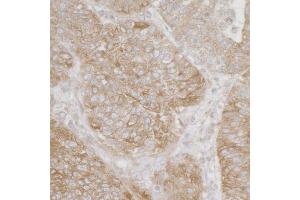 Immunohistochemistry (IHC) image for anti-Ribosomal Protein S3A (RPS3A) (AA 1-50) antibody (ABIN7455060) (RPS3A 抗体  (AA 1-50))