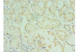 Immunohistochemistry of paraffin-embedded human kidney tissue using ABIN7173555 at dilution of 1:100 (TMOD3 抗体  (AA 1-352))
