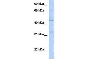 Western Blotting (WB) image for anti-Transcription Factor AP-2 beta (Activating Enhancer Binding Protein 2 Beta) (TFAP2B) (C-Term) antibody (ABIN2780496)