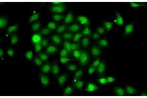 Immunofluorescence analysis of A-549 cells using COPS2 Polyclonal Antibody (COPS2 抗体)