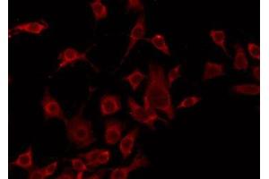 ABIN6275247 staining HeLa by IF/ICC. (TOMM20 抗体  (Internal Region))