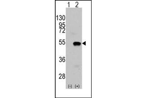 Image no. 1 for anti-SET and MYND Domain Containing 2a (SMYD2A) (N-Term) antibody (ABIN356582) (SMYD2A 抗体  (N-Term))