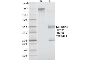 SDS-PAGE Analysis Purified Insulin Receptor Mouse Monoclonal Antibody (INSR/1661). (Insulin Receptor 抗体  (Extracellular Domain))