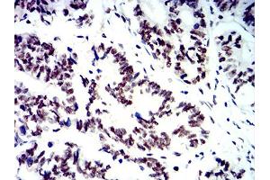 Immunohistochemistry (IHC) image for anti-SWI/SNF Related, Matrix Associated, Actin Dependent Regulator of Chromatin, Subfamily A, Member 1 (SMARCA1) (AA 933-1070) antibody (ABIN5611352)