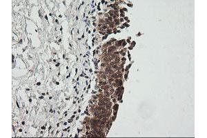 Image no. 2 for anti-Cyclin-Dependent Kinase Inhibitor 2B (p15, Inhibits CDK4) (CDKN2B) antibody (ABIN1497447) (CDKN2B 抗体)