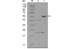 Western Blot showing EPHA5 antibody used against truncated EPHA5-His recombinant protein (1) and truncated EPHA5 (aa620-774)-hIgGFc transfected CHO-K1 cell lysate (2). (EPH Receptor A5 抗体  (AA 620-774))