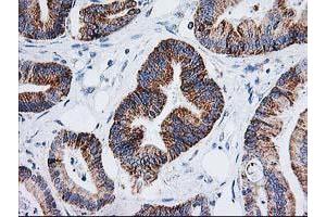 Image no. 1 for anti-Adenylate Kinase 4 (AK4) antibody (ABIN1496525) (AK4 抗体)