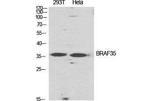 Western Blot (WB) analysis of specific cells using BRAF35 Polyclonal Antibody. (HMG20B 抗体  (N-Term))