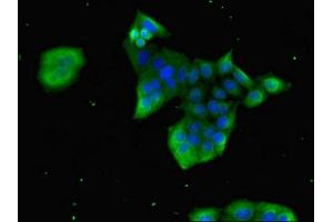 Immunofluorescent analysis of PC-3 cells using ABIN7153675 at dilution of 1:100 and Alexa Fluor 488-congugated AffiniPure Goat Anti-Rabbit IgG(H+L) (Gastrin-Releasing Peptide 抗体  (AA 31-98))