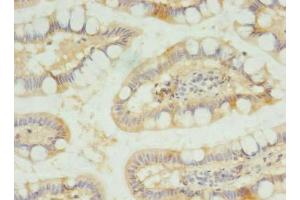 Immunohistochemistry of paraffin-embedded human small intestine tissue using ABIN7170170 at dilution of 1:100 (SLC23A1 抗体  (AA 173-259))