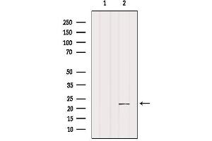Western blot analysis of extracts from Mouse muscle, using SAR1A Antibody.