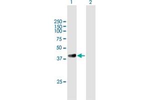 Western Blot analysis of GRAP2 expression in transfected 293T cell line by GRAP2 MaxPab polyclonal antibody. (GRAP2 抗体  (AA 1-330))