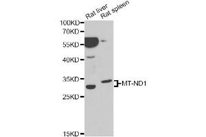 Western blot analysis of extracts of various cell lines, using MT-ND1 antibody. (MT-ND1 抗体)